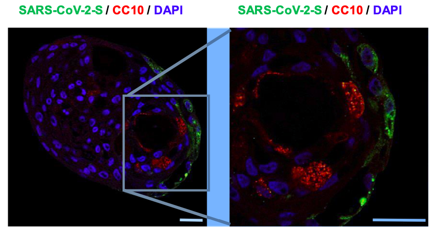 Modelo de órgão in vitro pulmão para covid 19 sars cov 2