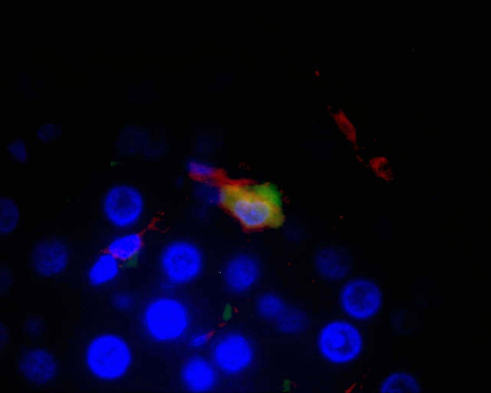 Imagem, com fundo preto, de células brilhando em azul e apenas uma, o macrófago, brilhando em vermelho, amarelo e verde.