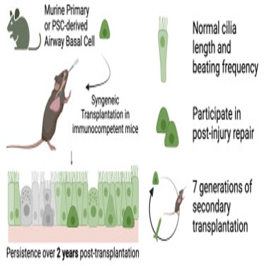 pulmão celulas pulmonares