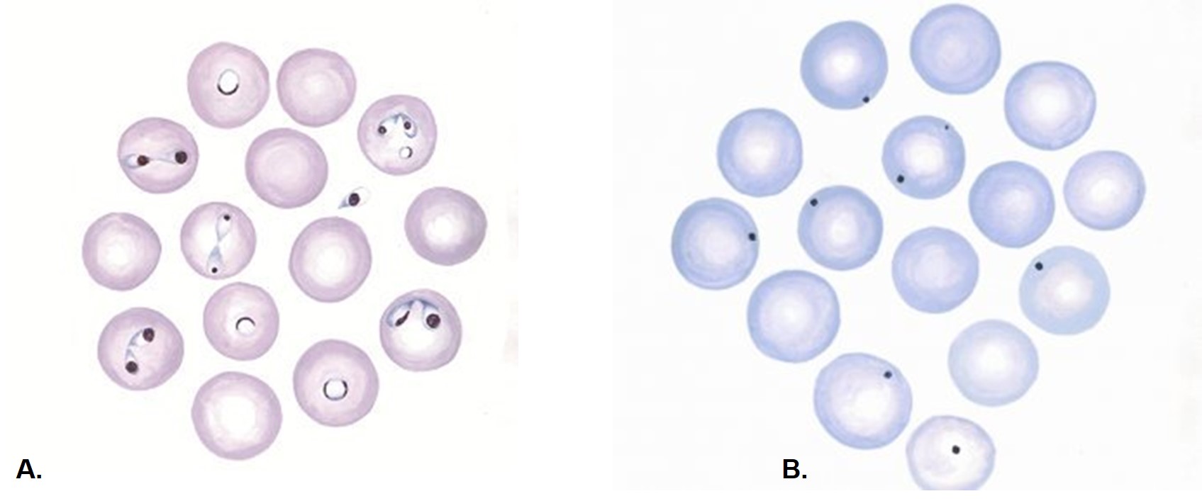 tristeza parasitária bovina